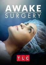 Awake Surgery