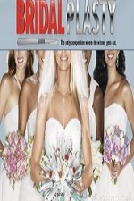 Bridalplasty